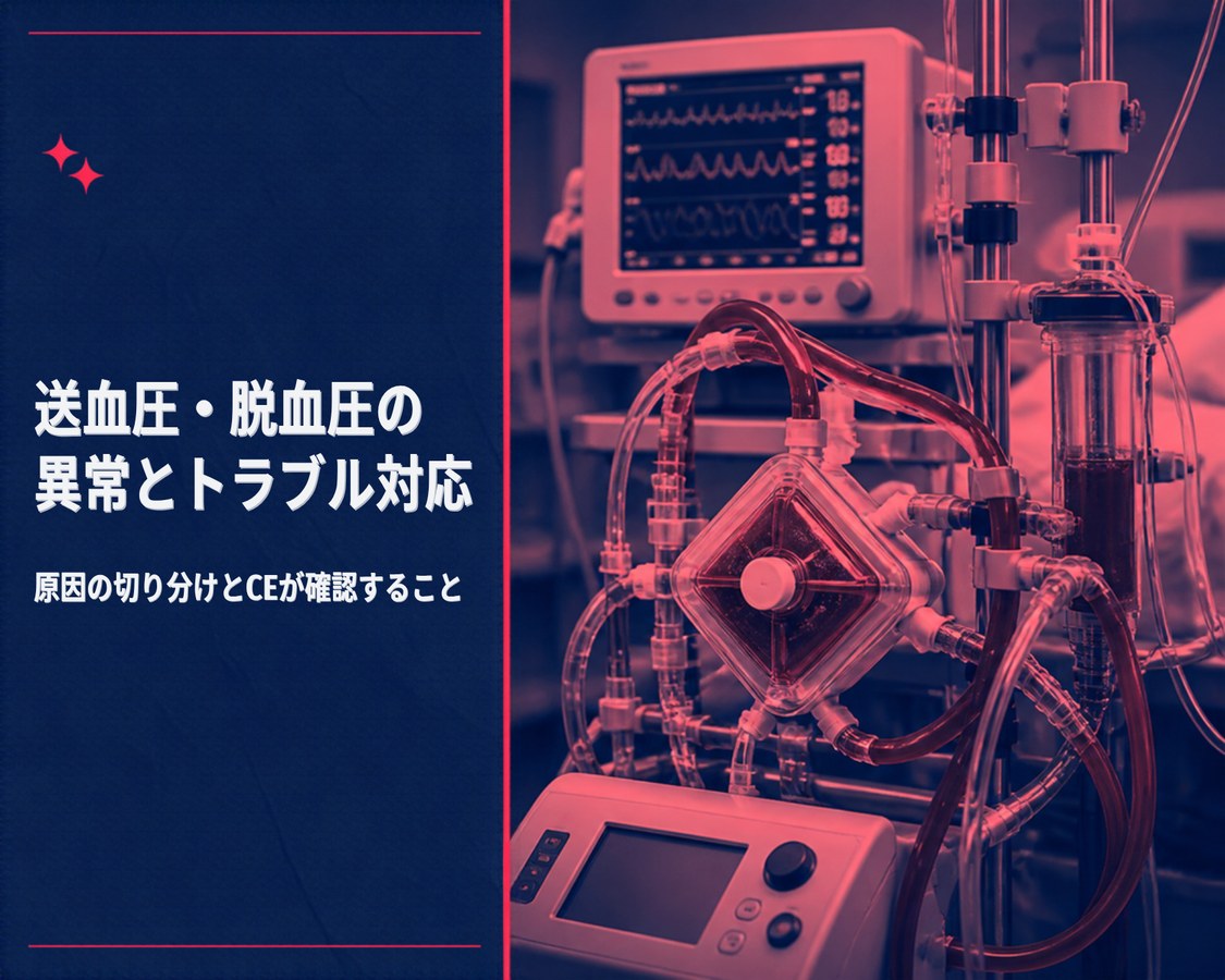ECMOの送血圧・脱血圧の異常とトラブル対応