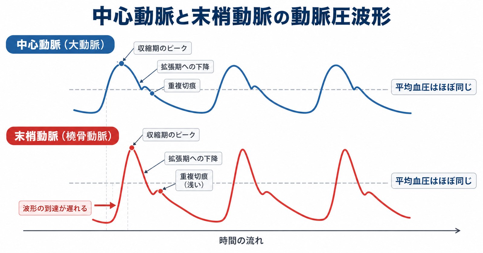 中心動脈(大動脈)と末梢動脈(橈骨動脈)の動脈圧波形を重ねて比較した図。末梢ほど収縮期ピークが高く鋭く、ディクロティックノッチが遅れて浅くなる