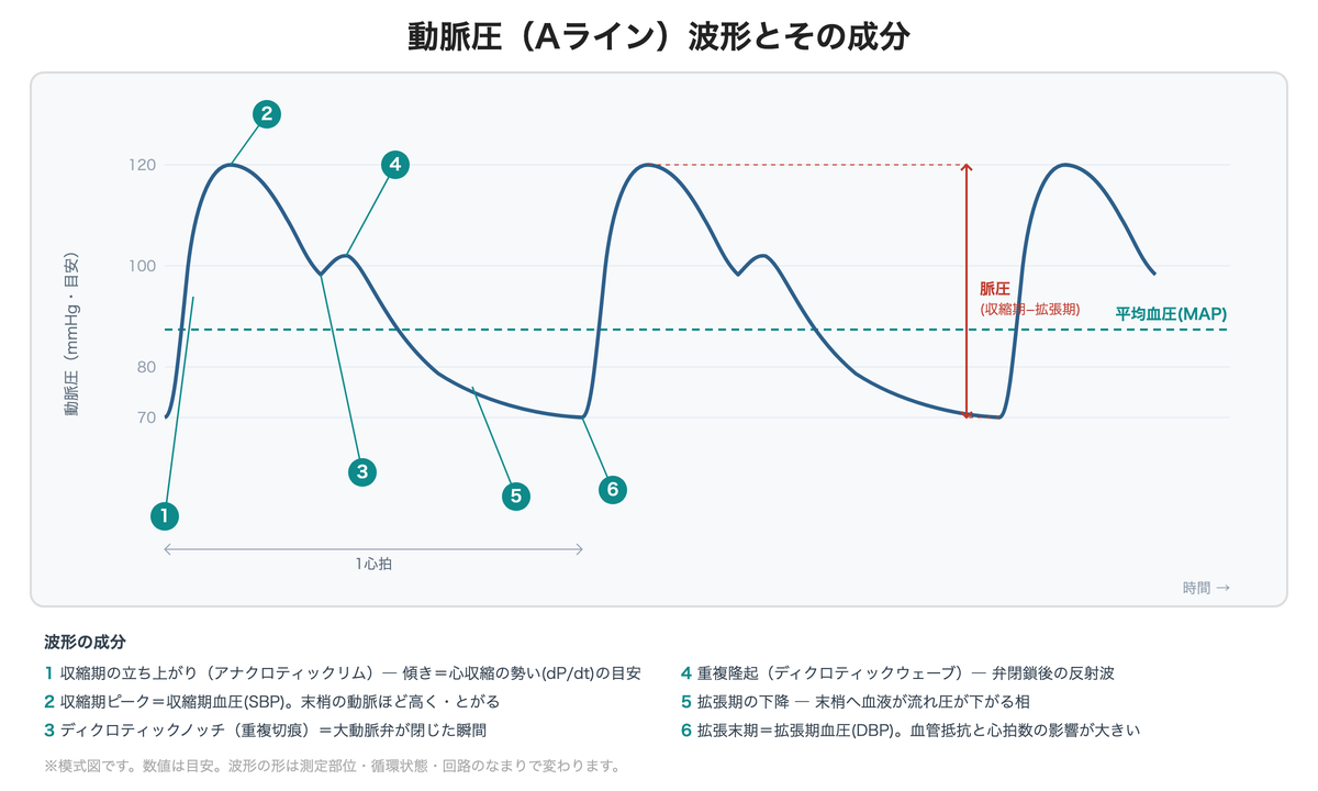 動脈圧波形の各成分(立ち上がり・収縮期ピーク・ディクロティックノッチ・拡張期下降・拡張期血圧)を番号で示した模式図