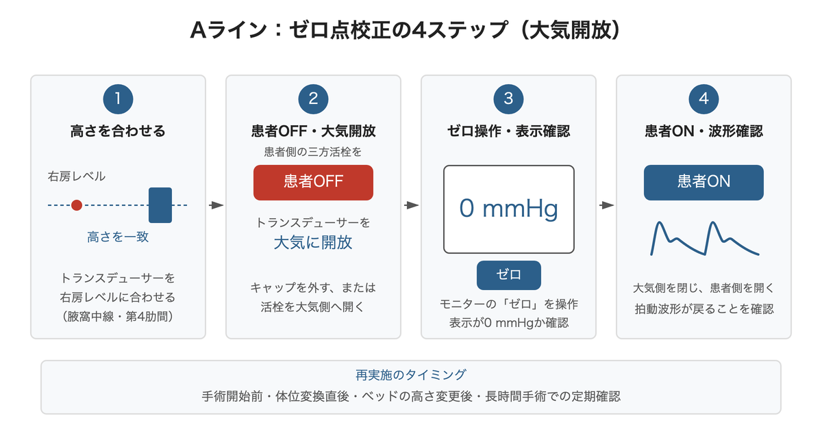 ゼロ点校正の4ステップ(高さ合わせ・大気開放・ゼロ操作・患者ONでの波形確認)を示す図