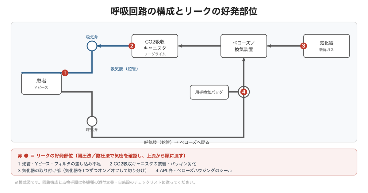 呼吸回路とリークテストで漏れやすい箇所(模式図)