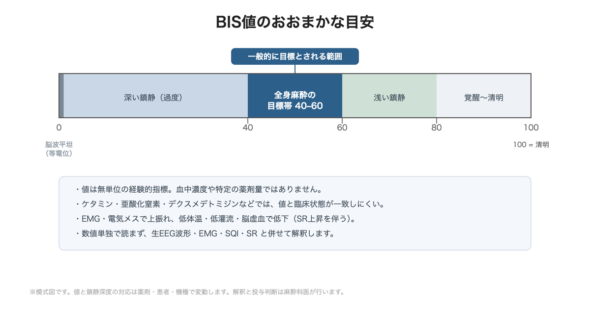 BIS値の目安と鎮静深度の対応(模式図)