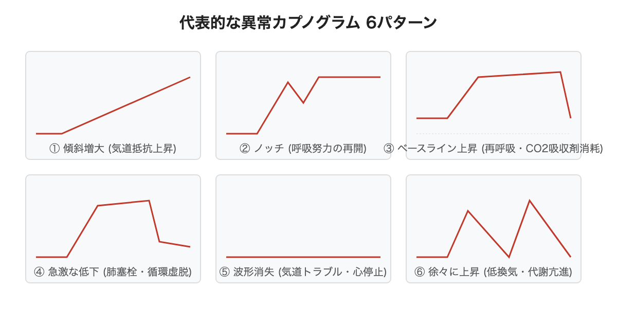 代表的な異常カプノグラム6パターンの波形比較