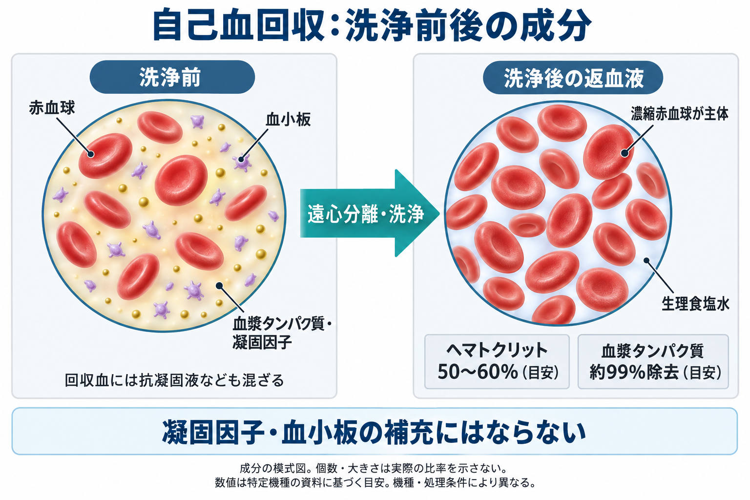 洗浄前の赤血球・血漿タンパク質・凝固因子・血小板を含む回収血と、洗浄後の生理食塩水中の濃縮赤血球を対比した模式図