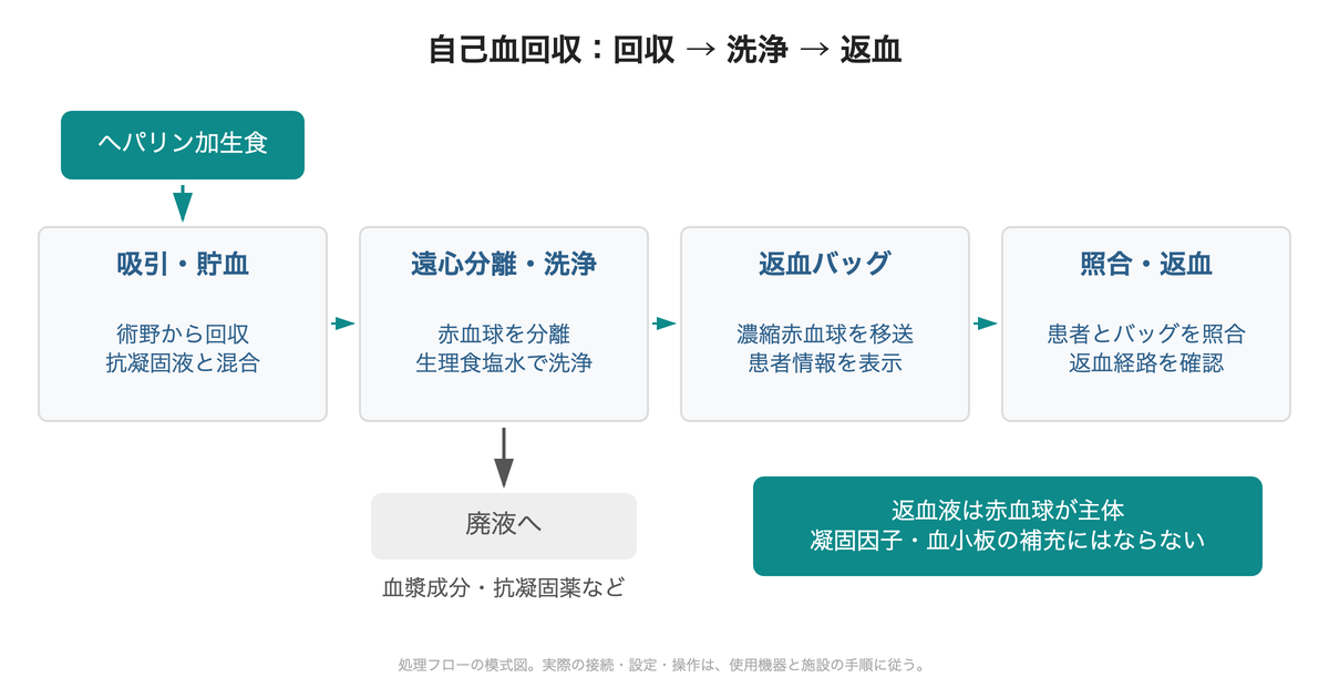 抗凝固液を加えながら吸引・貯血し、遠心分離と洗浄を経て濃縮赤血球を返血バッグへ移す流れ。廃液経路は返血経路から分かれる