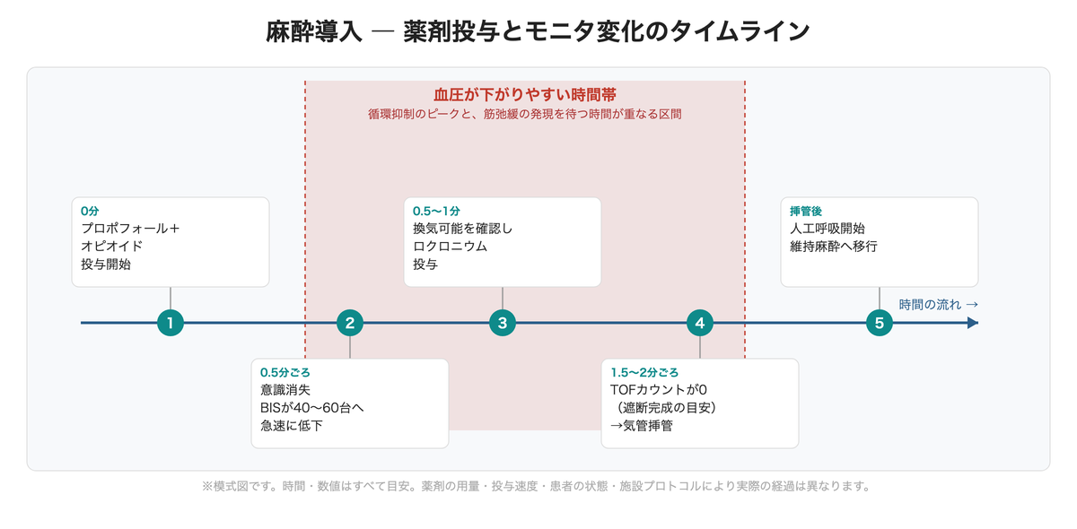 麻酔導入 ― 薬剤投与とモニタ変化のタイムライン(模式図)