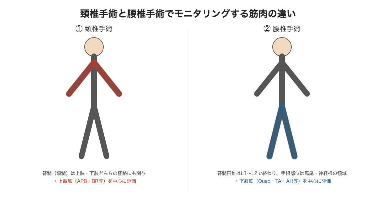 頸椎手術と腰椎手術でモニタリングする筋肉の違い