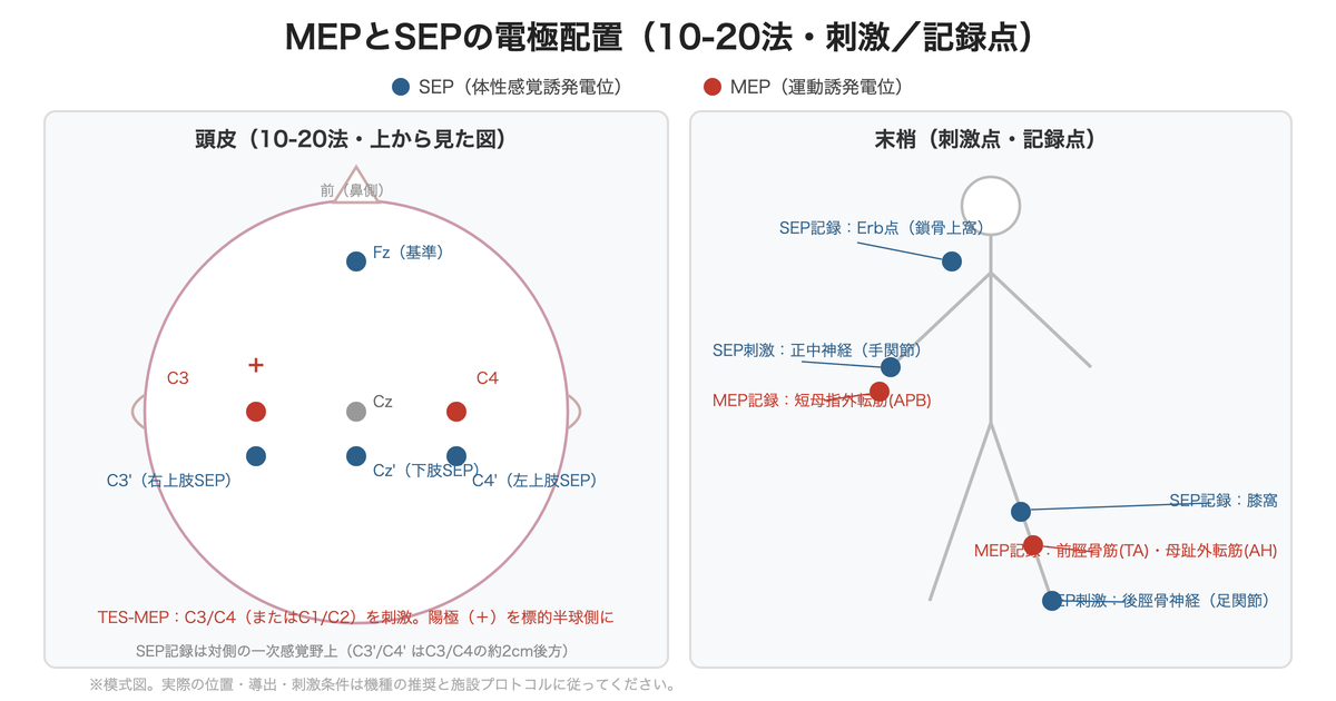 MEPとSEPの電極配置 ― 10-20法の頭皮位置と末梢の刺激点・記録点