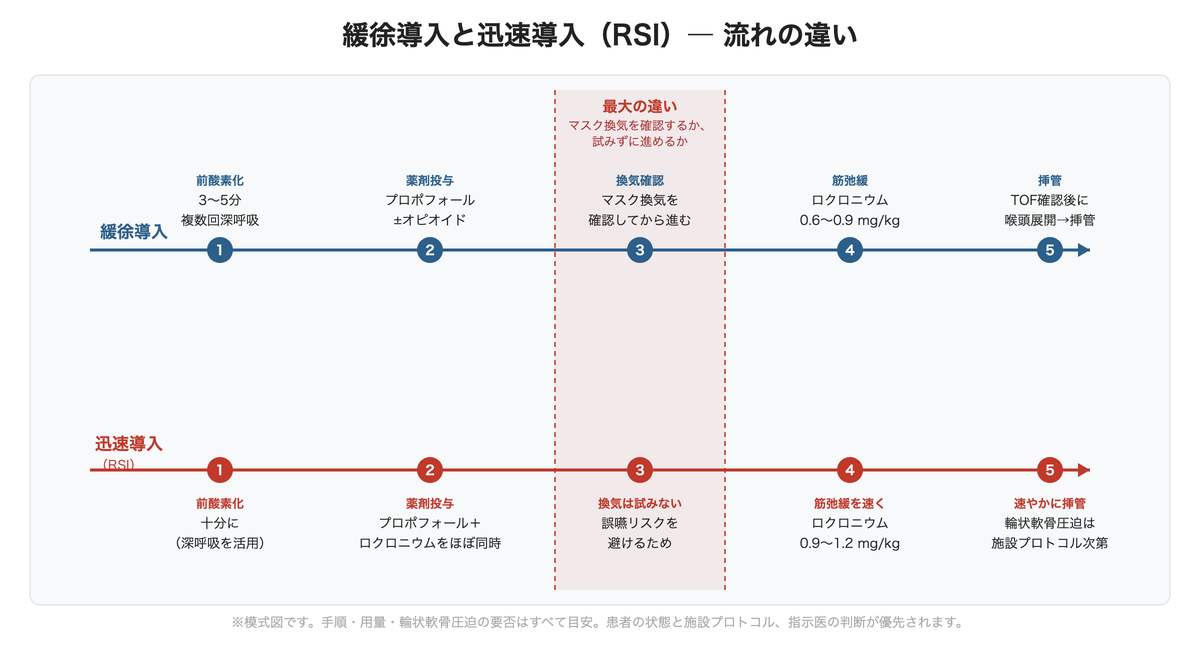 緩徐導入と迅速導入(RSI)― 流れの違い(模式図)