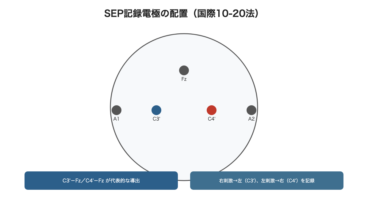 SEP記録電極の配置(国際10-20法)