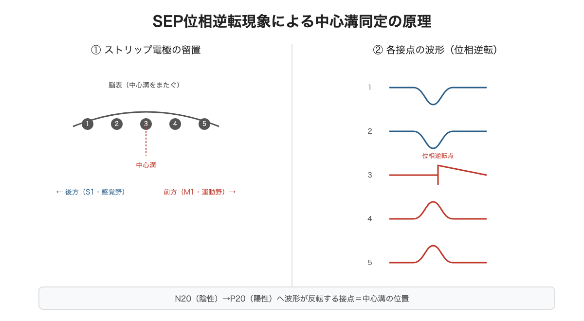 SEP位相逆転現象による中心溝同定の原理
