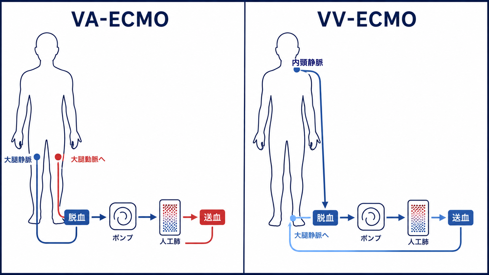 VA-ECMOとVV-ECMOの回路比較図