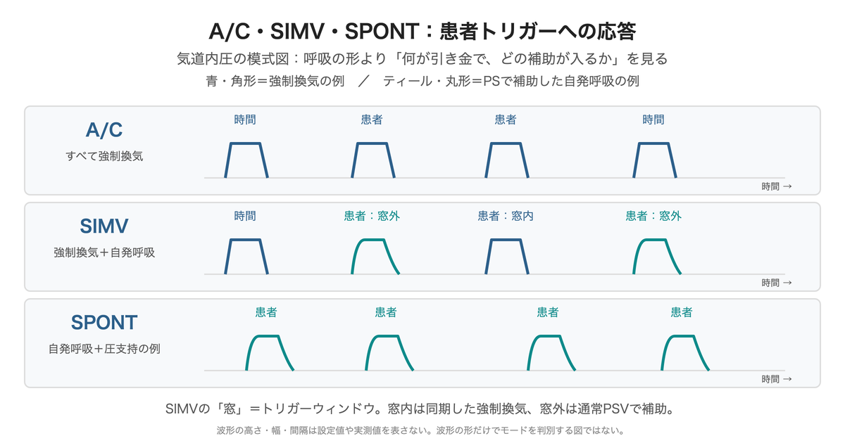A/Cは時間・患者トリガーとも強制換気。SIMVはトリガーウィンドウ内で強制換気、外で通常PSV。SPONTは自発呼吸を圧支持で補助した例。